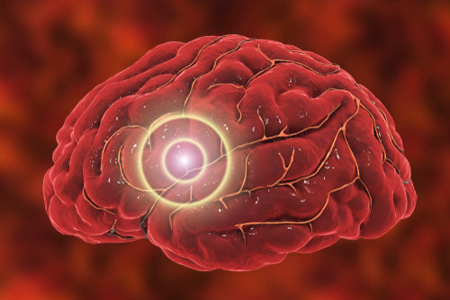 How to Reduce Brain Inflammation and Improve Overall Brain Health